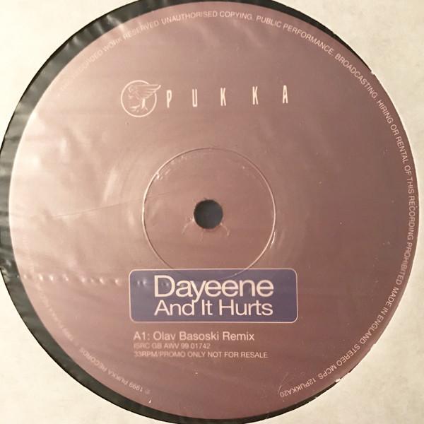 DaYeene - And It Hurts